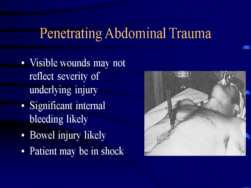 Penetrating Abdominal Trauma Visible wounds may not reflect severity of underlying injury Significant internal